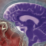 brain enhancements