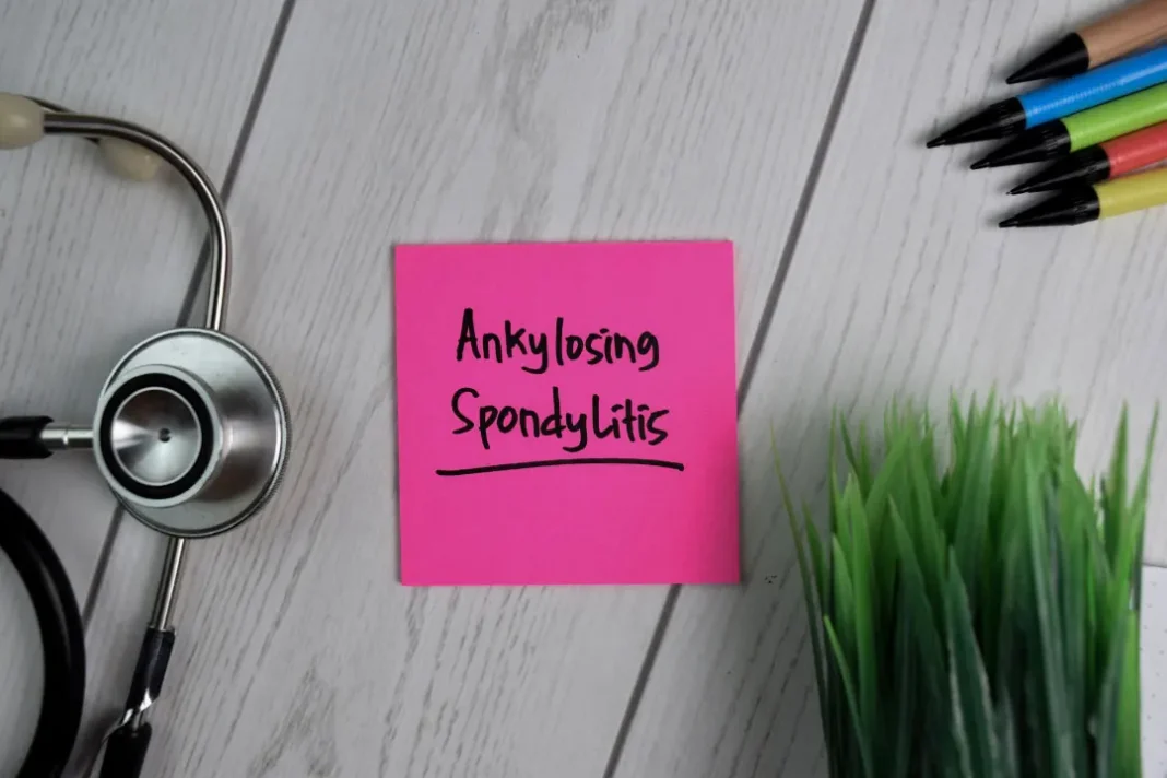 Ankylosing Spondylitis.